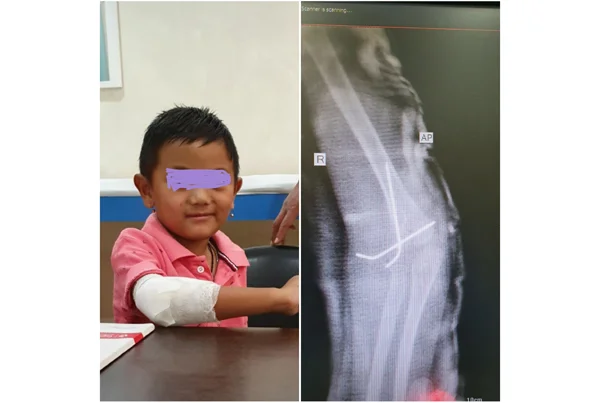 Best Bone Clinic