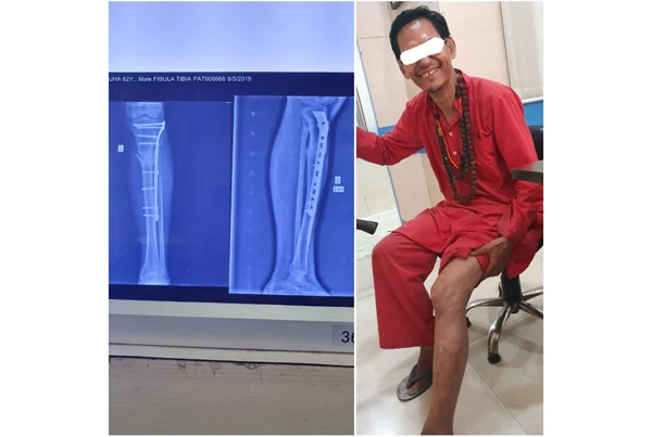 Best Bone Clinic