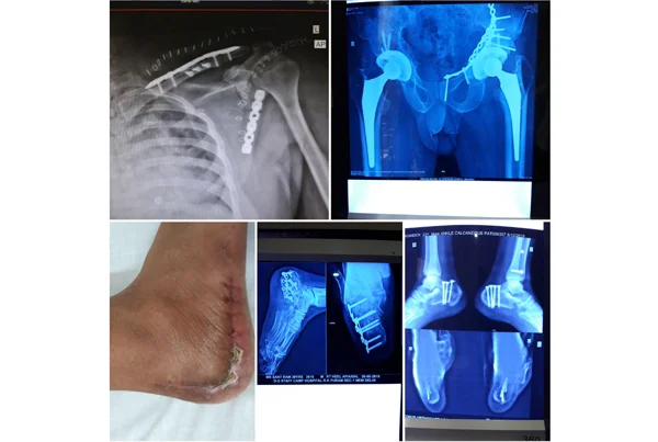 Best Bone Clinic