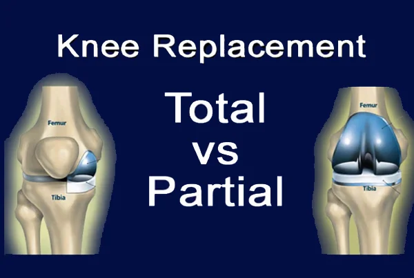 Total and Partial Knee Replacement Surgeries