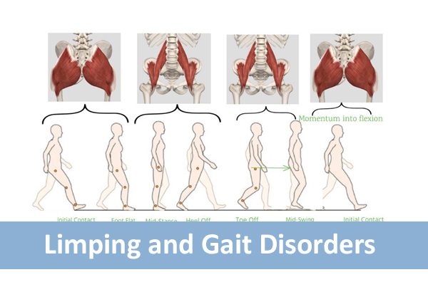 Limping and Gait Disorders