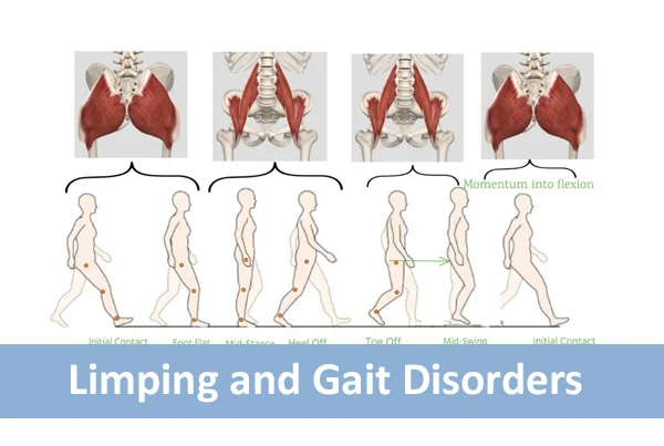 Limping and Gait Disorders