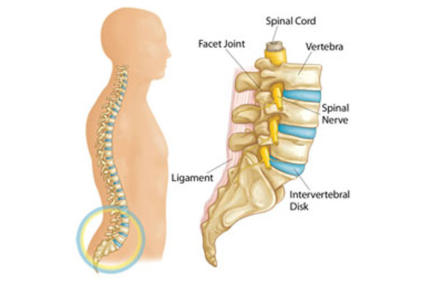Microdiscectomy