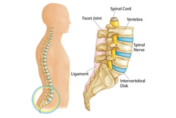 Microdiscectomy